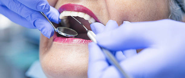 Best Emergency Treatment for Dental Infections or Abscesses in Knox, IN
